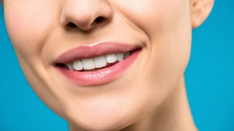 Hollywood Smile